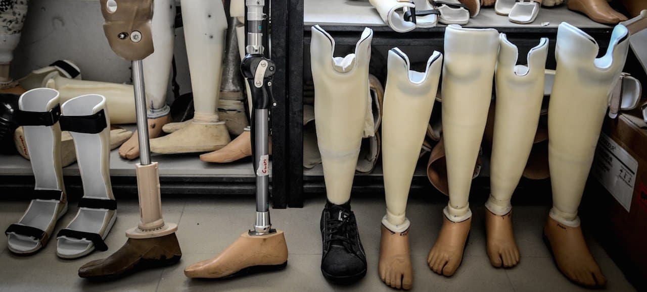 row_of_prosthetic_legs